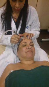 microdermabrasion-tampa