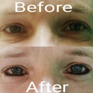 permanent makeup eyeliner before and after