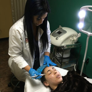 microneedling at bellissimo you spa tampa