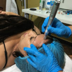 microneedling services in Tampa