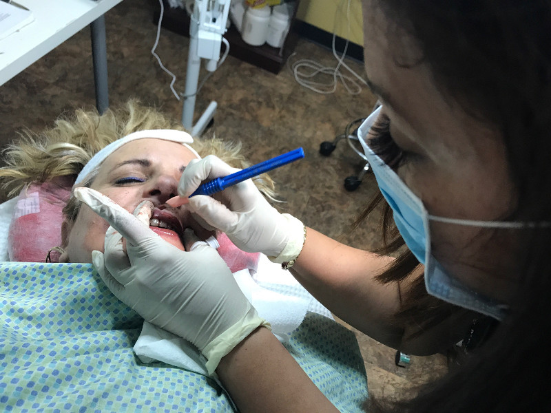 permanent makeup on lips