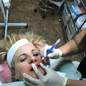 permanent makeup for lips at tampa spa