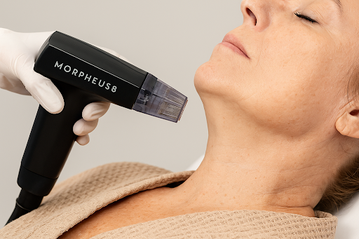 Close-up of Morpheus8 treatment on the neck to tighten sagging skin.