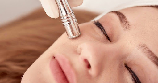 Close-up of a microdermabrasion tool exfoliating the skin.