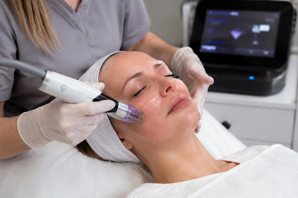Radio frequency microneedling treatment being performed on a client's face during a skin care session.